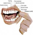 /album/wisdom-teeth/wisdome-tooth-2-jpg/